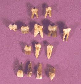 02teeth.bmp (72622 bytes)