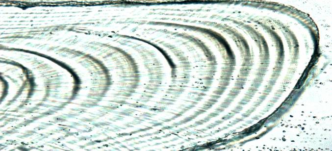 Sagittal otolith section from a juvenile red drum  